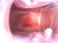 Screenshot A Speculum In The Pussy - Chloe Hd 720, 18, First Porn Actress, Masturbation, Toys, Public, Young