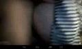 Screenshot Vulgar Periscope. Bent Girl With Cancer On Camera.