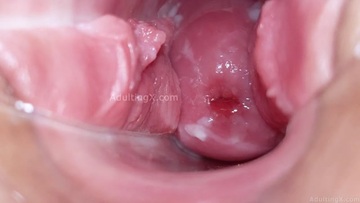 Screenshot Cervix on Display: A Game of Mirrors